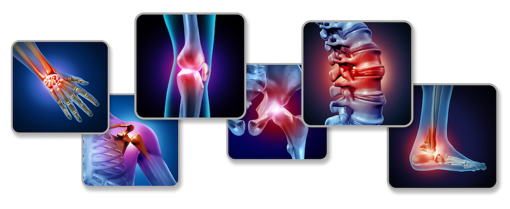 Neuroanatomy of pain processing
